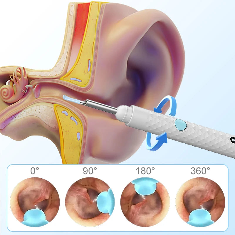 Smart WiFi Ear Camera Otoscope